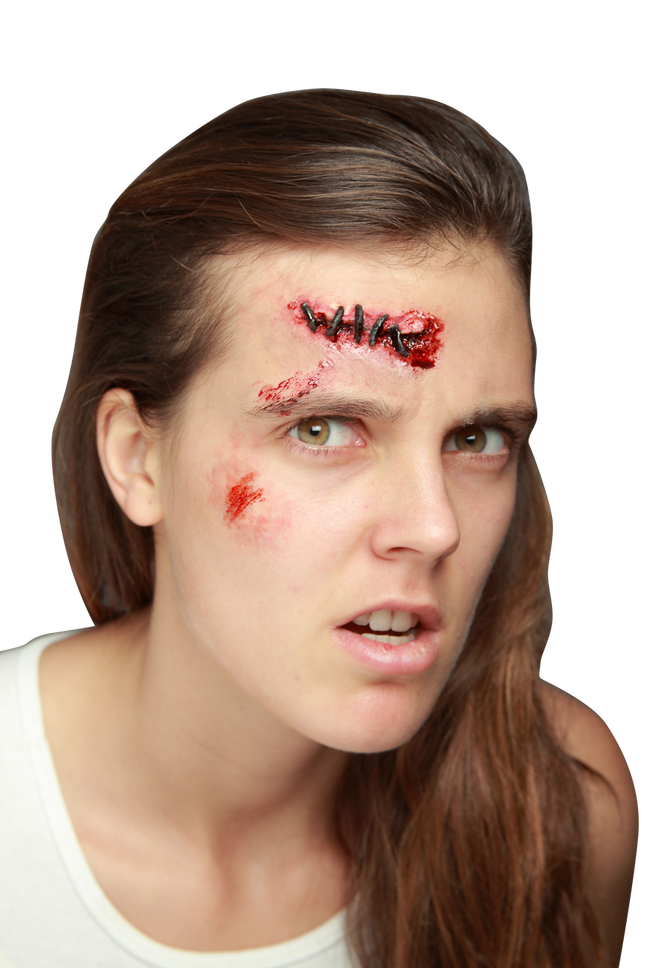 Appliance - Stitches