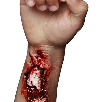 Appliance - Broken Arm