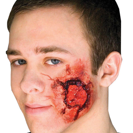 OPEN WOUND