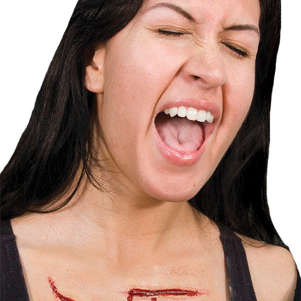 SCAR SET 2 GOUGE SET