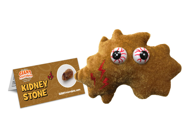 Kidney Stone- With Informational Tag