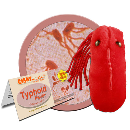 Typhoid Fever