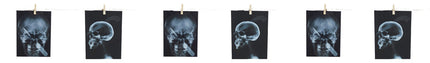 GARLAND-TORTURE X-RAY 63 IN.