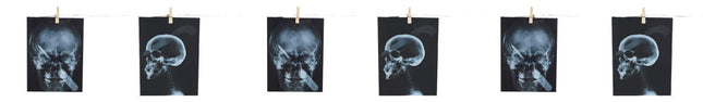 GARLAND-TORTURE X-RAY 63 IN.