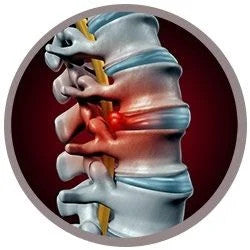 back pain illustration