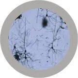 brain cell under the microscope
