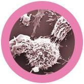 Malignant Neoplasm