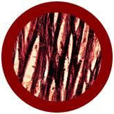 Cardiomyocyte