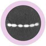 Streptococcus mutans