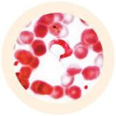 Trypanosoma cruzi