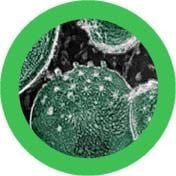 Chlamydia- Under the Microscope