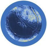 Vibrio cholerae