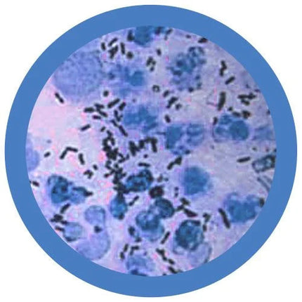 The Clap - Gonorrhea

