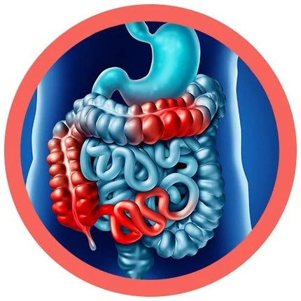 Crohn's & Colitis illustration