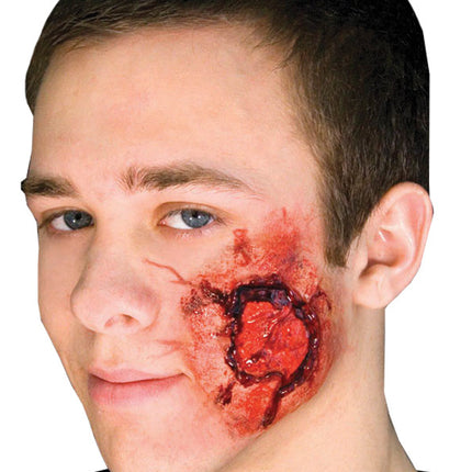 EZ FX OPEN WOUND KIT