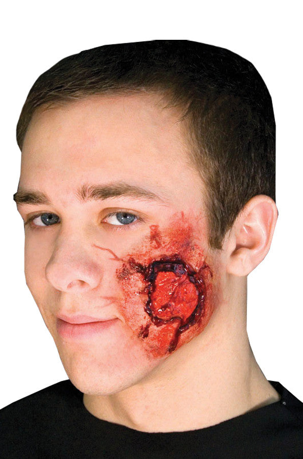 EZ FX OPEN WOUND KIT