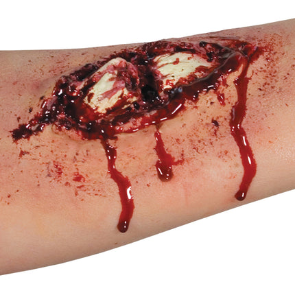 BROKEN BONE EZ FX KIT