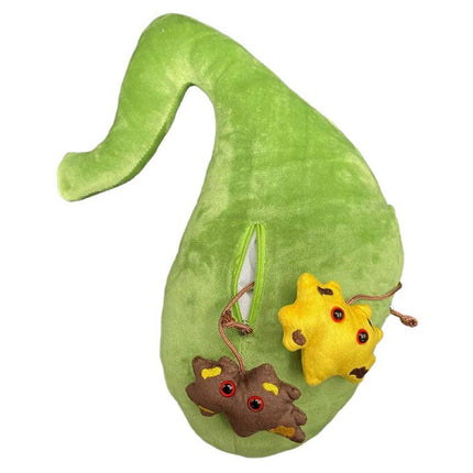 Deluxe Gallbladder w gallstones