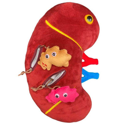 Deluxe Kidney with Kidney Stone