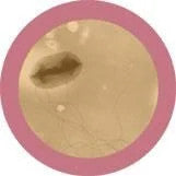 e. coli under the microscope
