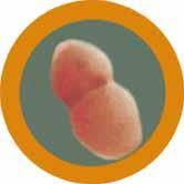 Streptococcus pneumoniae