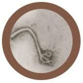 Ebola Virus- Under Microscope