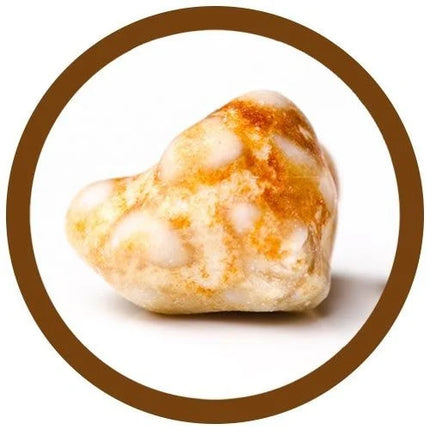 real gallstone photo
