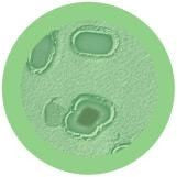 Clostridium perfringens