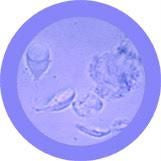 Giardia lamblia