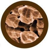 Cirrhosis