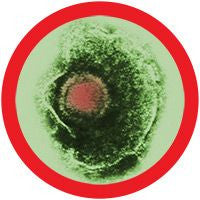 Herpes simplex virus-1