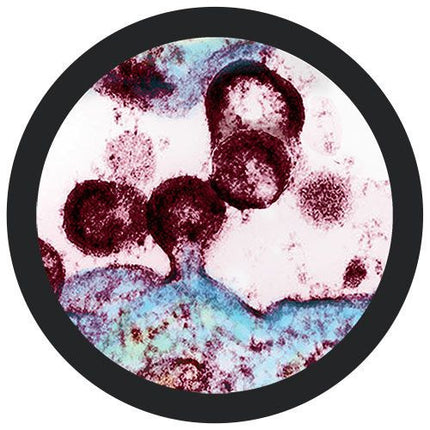 Human Immunodeficiency Virus