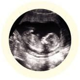 Human Being/ Homo Sapien- Ultrasound Photo