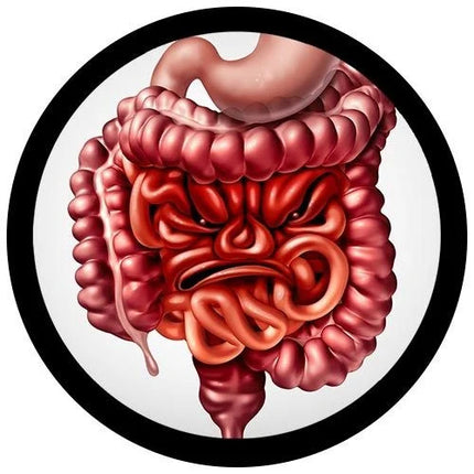 IBS- Irritable Bowel Syndrome- illustration