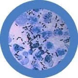 The Clap- Gonorrhea- Under Microscope