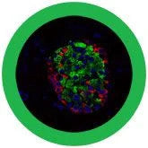 Beta Cell/Diabetes- Microscope View
