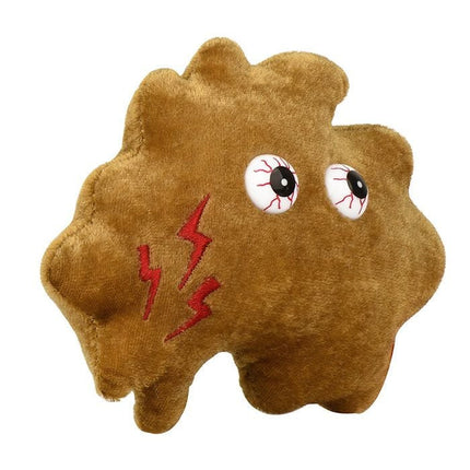 Kidney Stone- Angled View