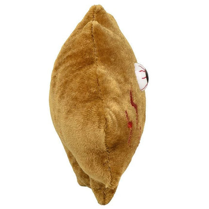 Kidney Stone- Side View