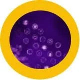 Kissing Disease under micrscope