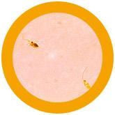 Leishmania tropica