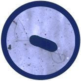 Listeria monoctyogenes