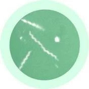 Lyme Disease under microscope
