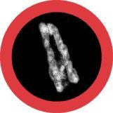 Bovine Spongiform Encephalopathy