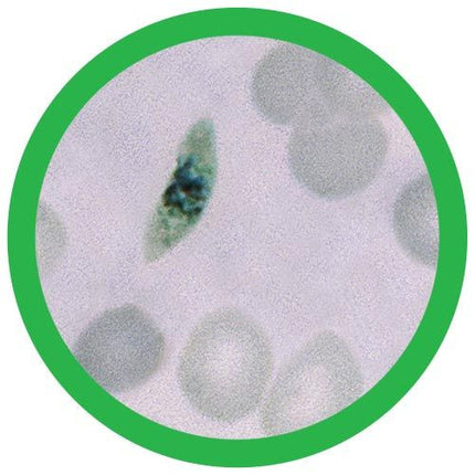 Malaria- Classic- Microscope View