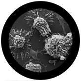 Malignant Neoplasm