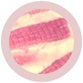 Myocyte