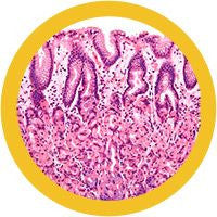 Parietal Cells