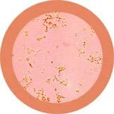 Pimple/ Acne- Microscope View