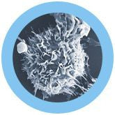 Malignant neoplasm