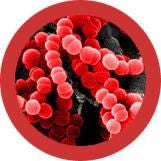 Sore throat/ Streptococcus- under the microscope